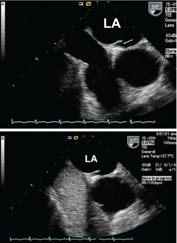 Fig4-Krishnan-March2025