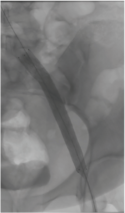 FigD-CLD-SeptOct 2026.png 
