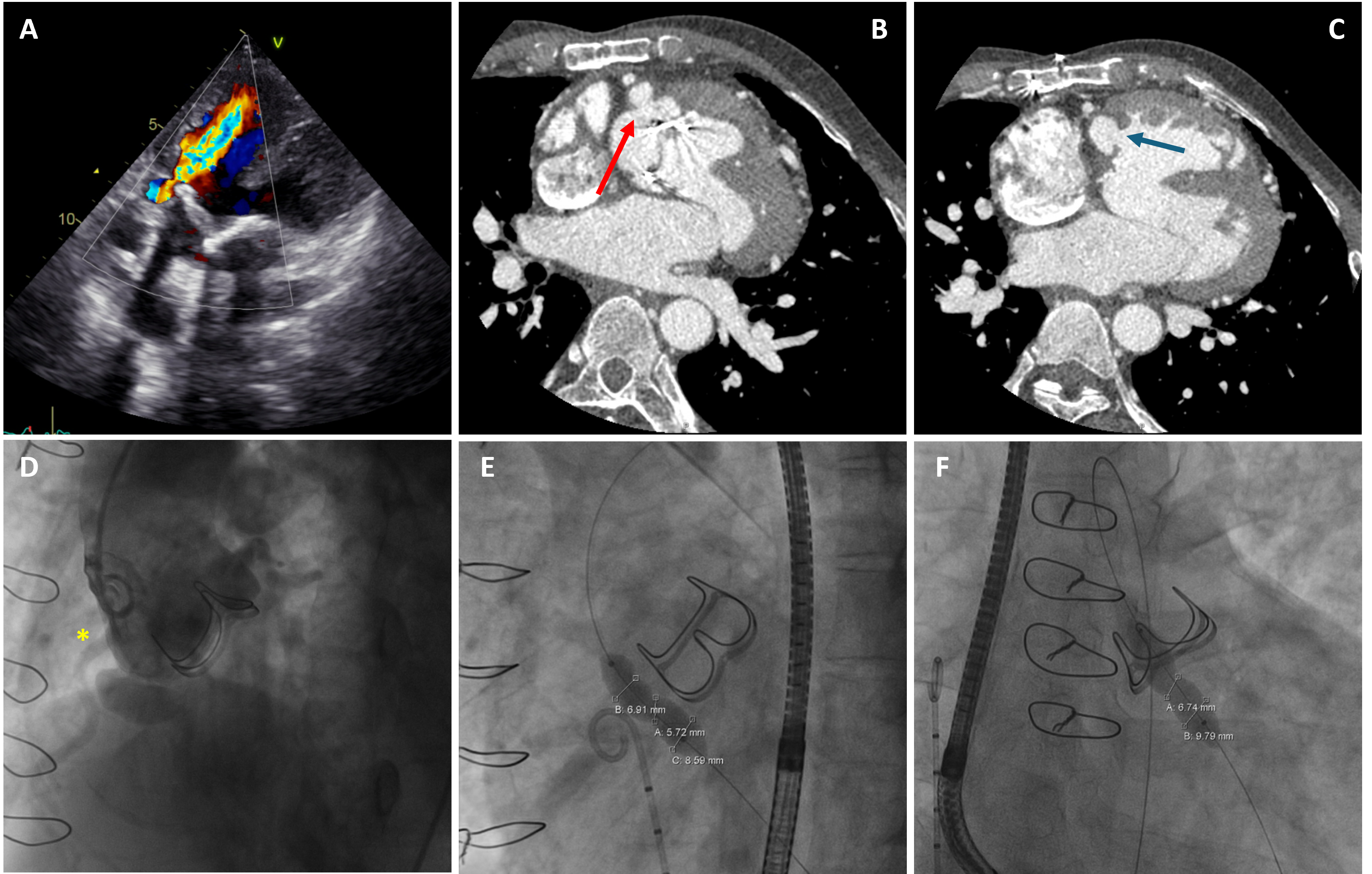 Figure 1. Baseline imaging
