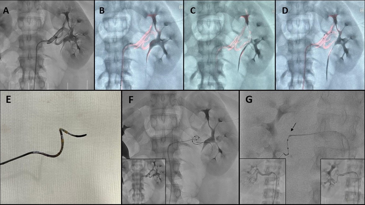 Figure. Highlights of the use of dynamic road-mapping