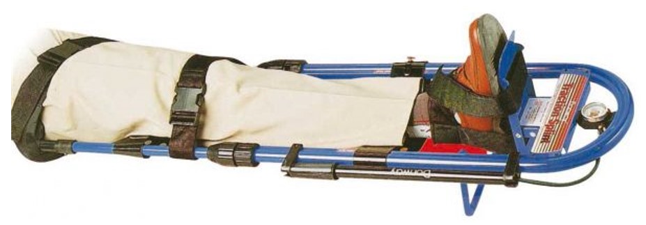 Figure 17: Donway splint with pressure gauge (Photo: SP Services)