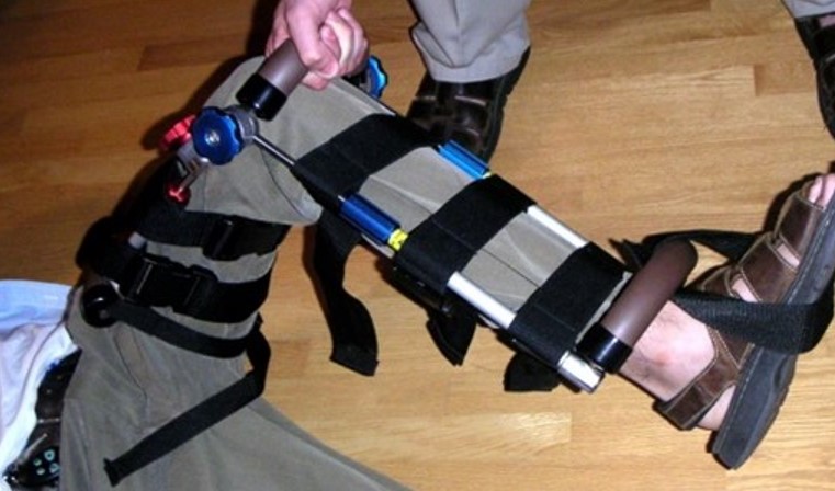 Figure 19: Reel Articulating Splint atop knee injury (Photo: A.J. Heightman)
