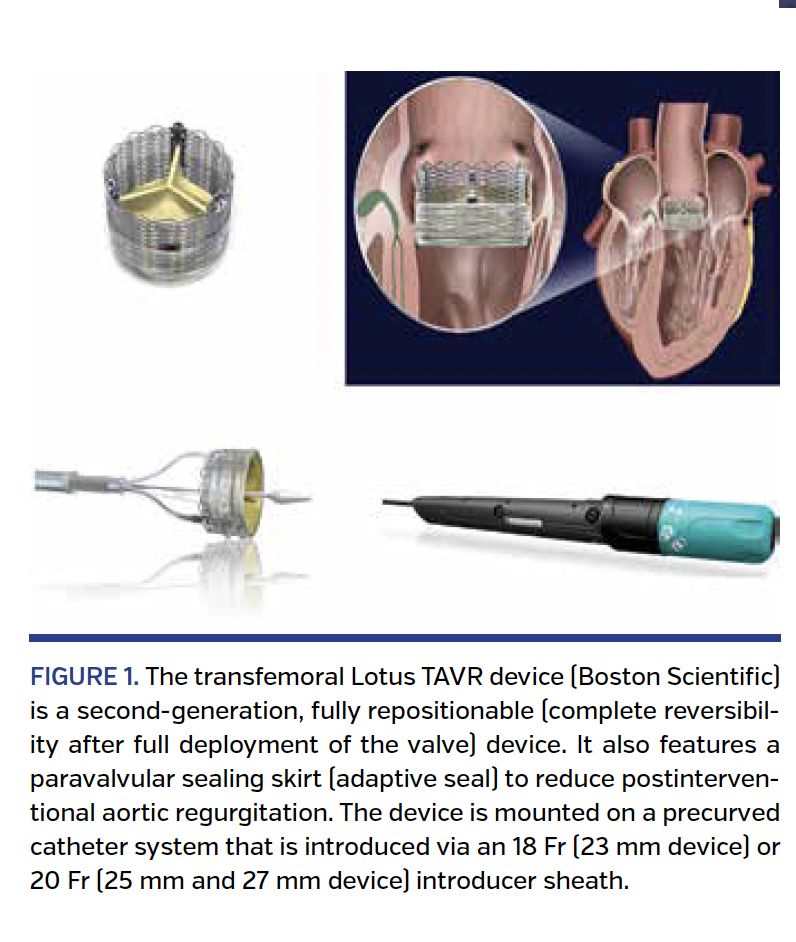 FIGURE 1. The transfemoral Lotus TAVR device