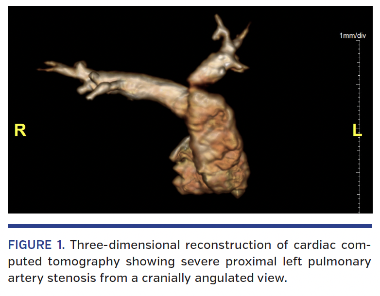 Cardiac computed tomography