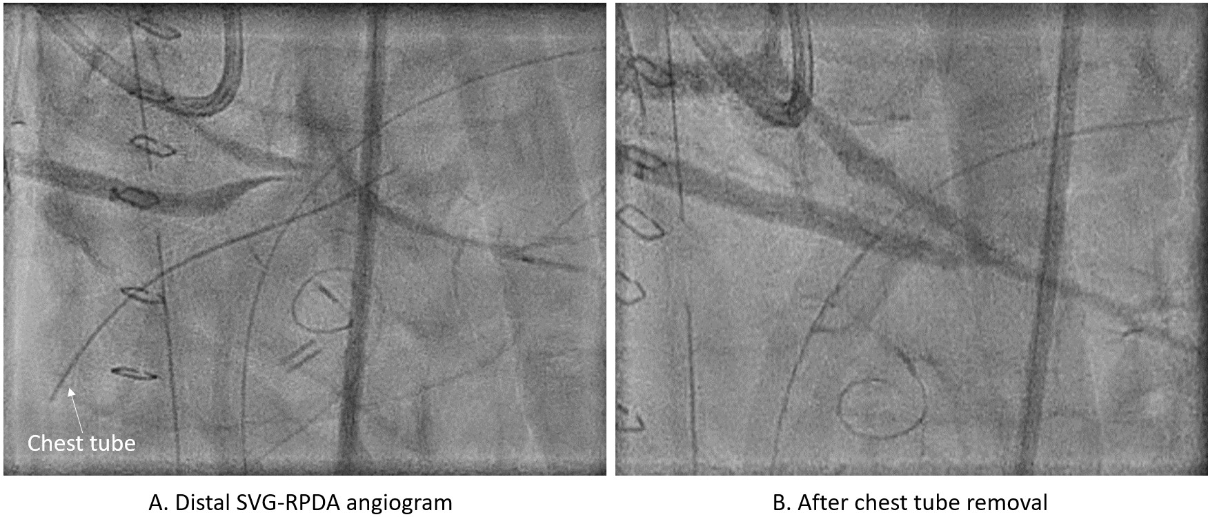 Figure. Angiogram 