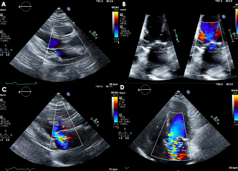 Figure 1. Transthoracic echocardiogram