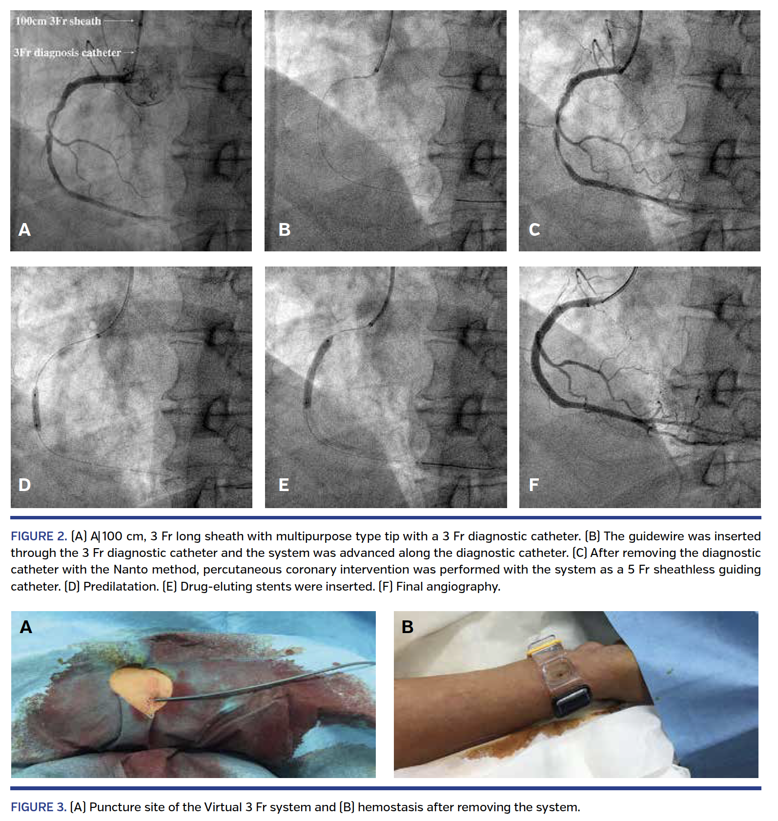 Virtual 3 Fr (V3) Registry