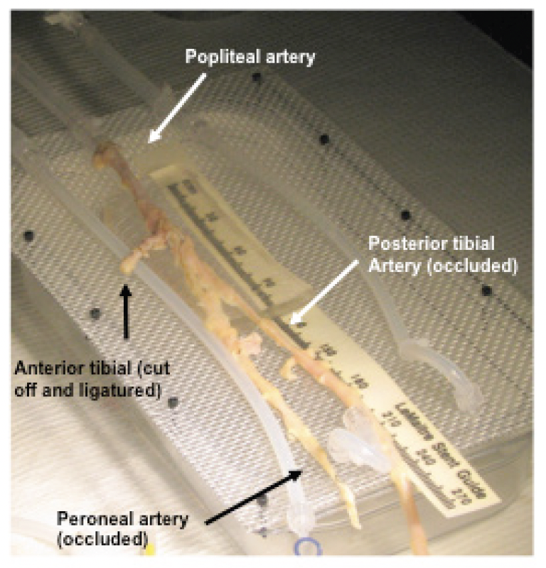 ull vascular model simulating an actual vascular tree