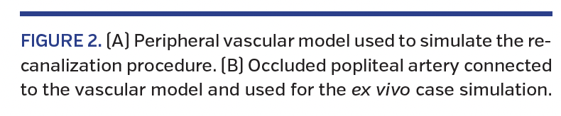 ull vascular model simulating an actual vascular tree