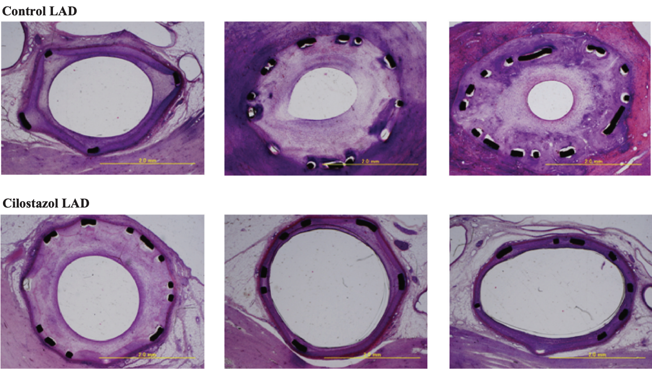 Figure 2. Histomorphometric images of arterial cross-sections processed 28 days after placement of control stents