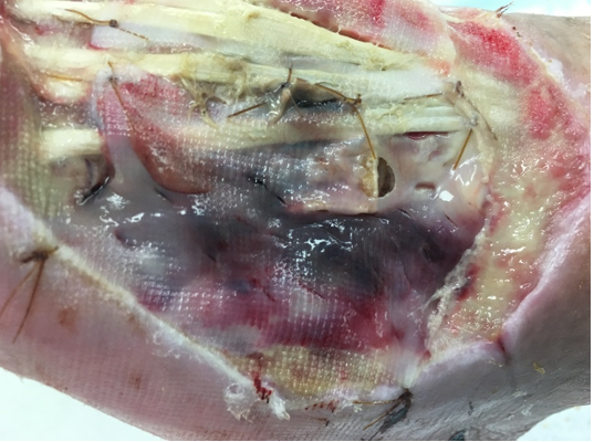 1 week after stravix tissue