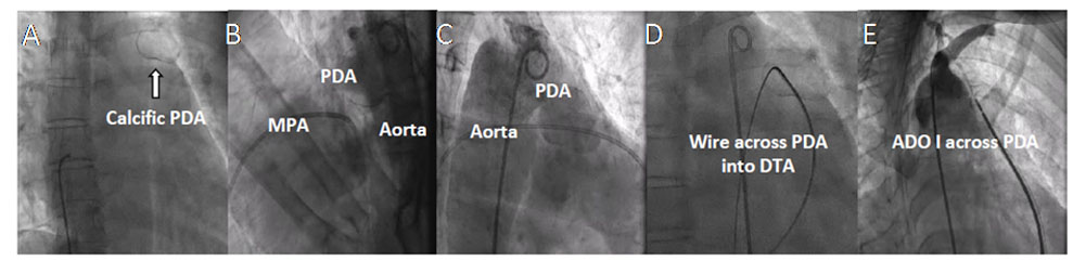 Figure 2. Fluoroscopic images