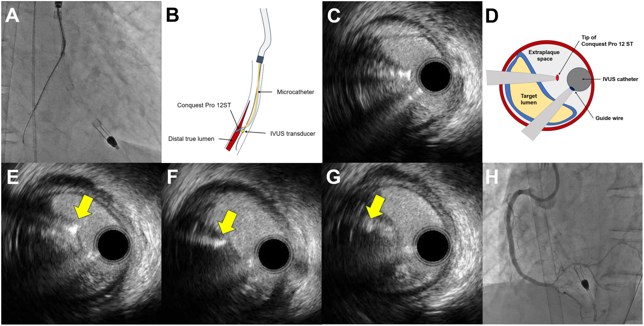 Figure 3. Illustration of the TD-ADR technique