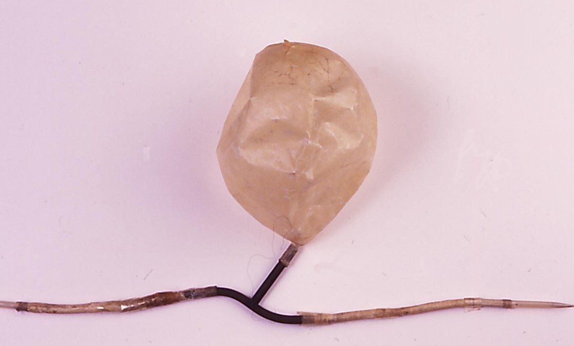 Pluma y vejiga IV de Wren (Foto: Museo Internacional de Ciencias Quirúrgicas)