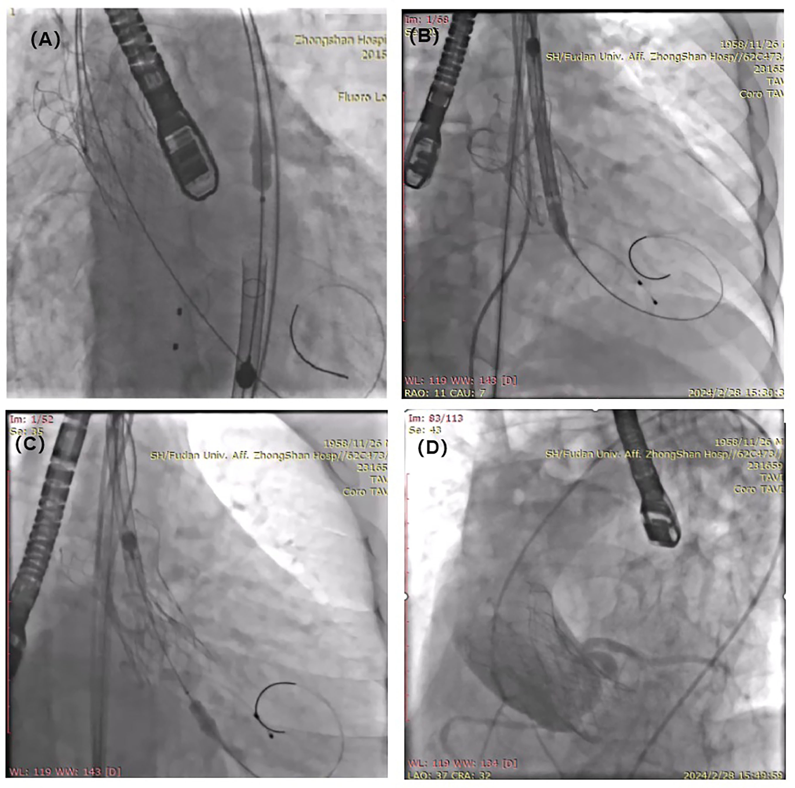 Figure 3. Rescue of an up-downward shift 