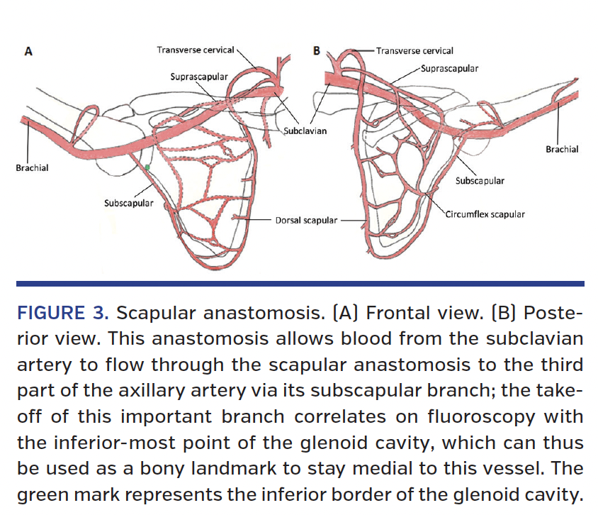 FIGURE 3. Scapular anastomosis. (A) Frontal view. (B) Posterior view.