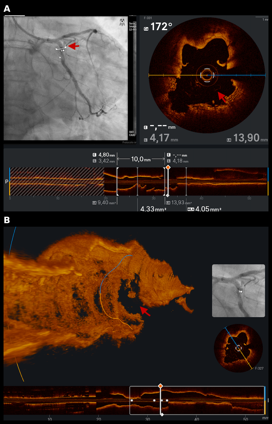 Figure 3. Optical coherence tomography