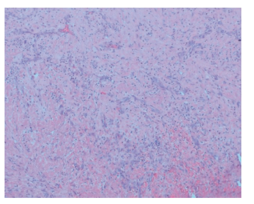 Figure 4 Mukit Masson