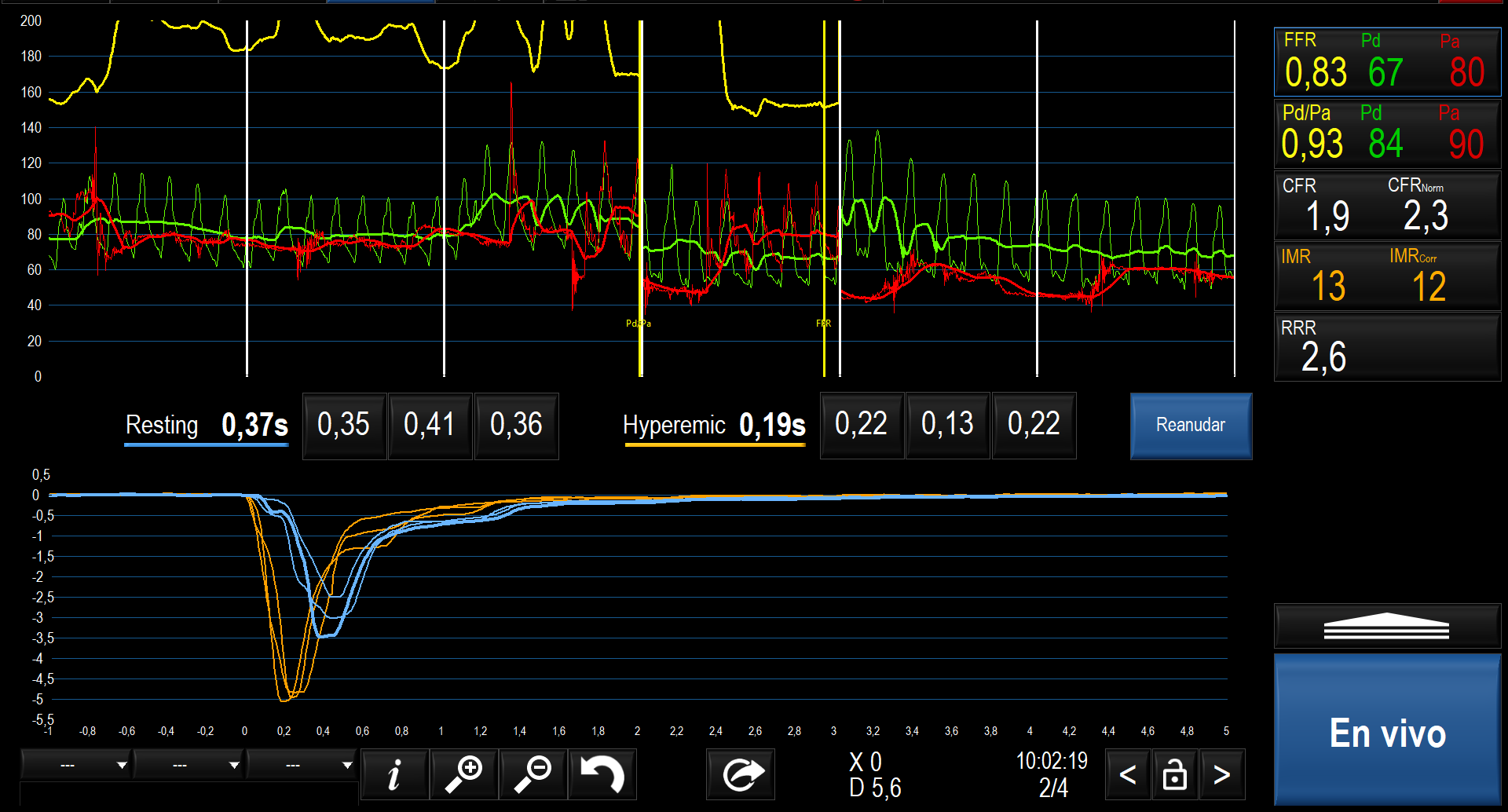 Figure 4. Microcirculation assessment showed no small vessel impairment