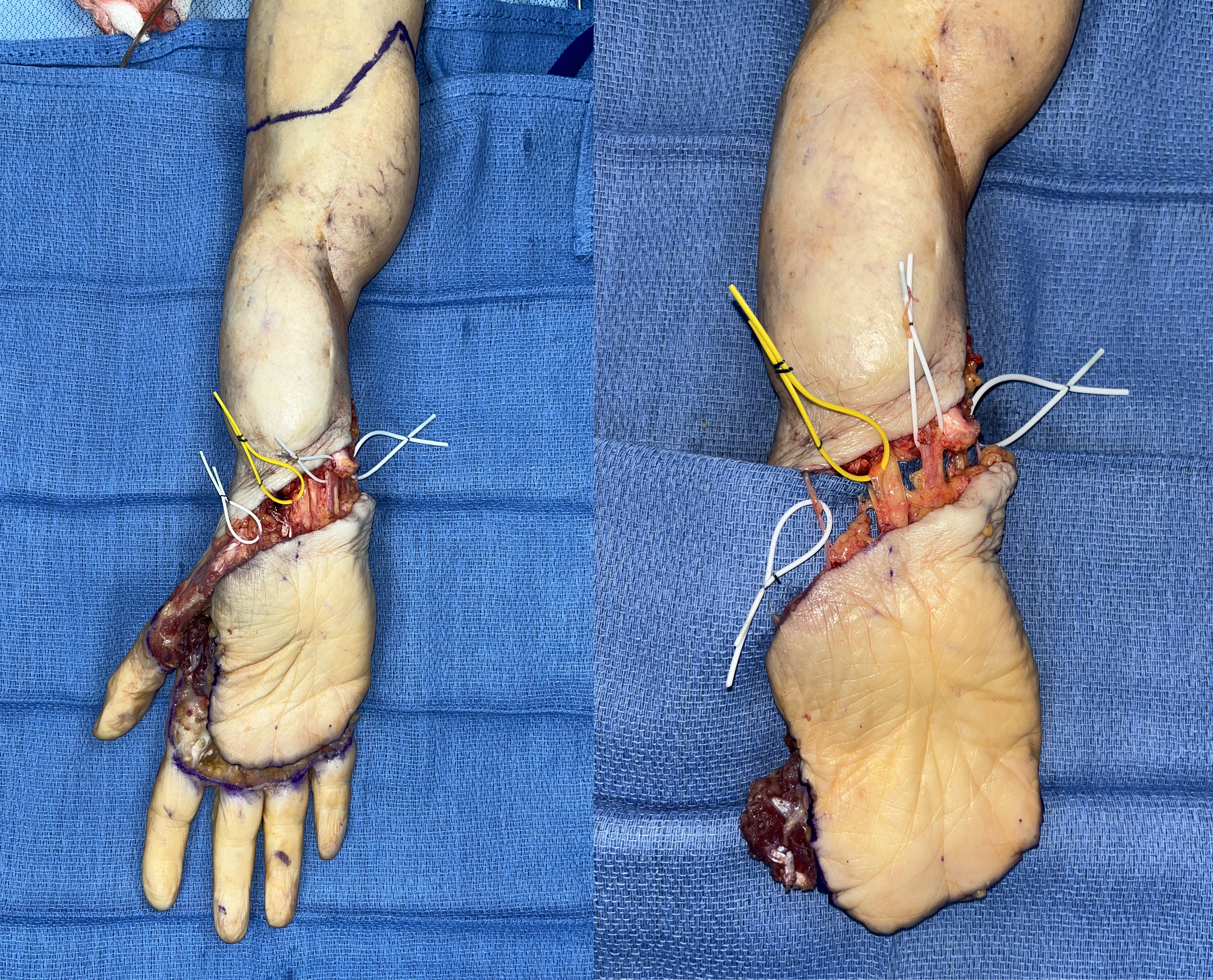 Figure 4: Completed elevation of the flap. 