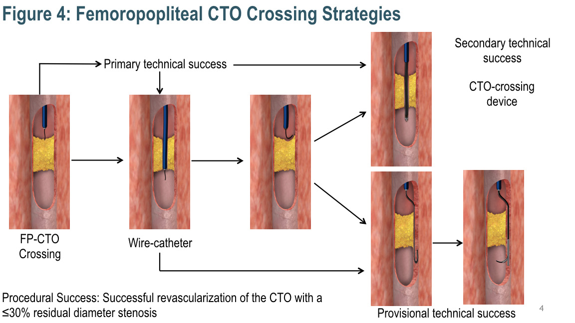 FIGURE 4. Femoropopliteal (FP) chronic total occlusion (CTO) crossing strategies.