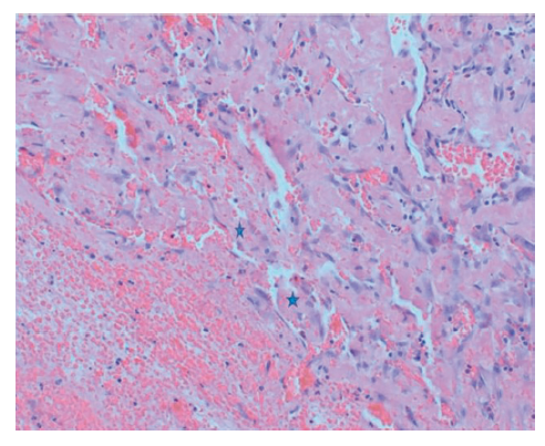 Figure 5 Mukit Masson