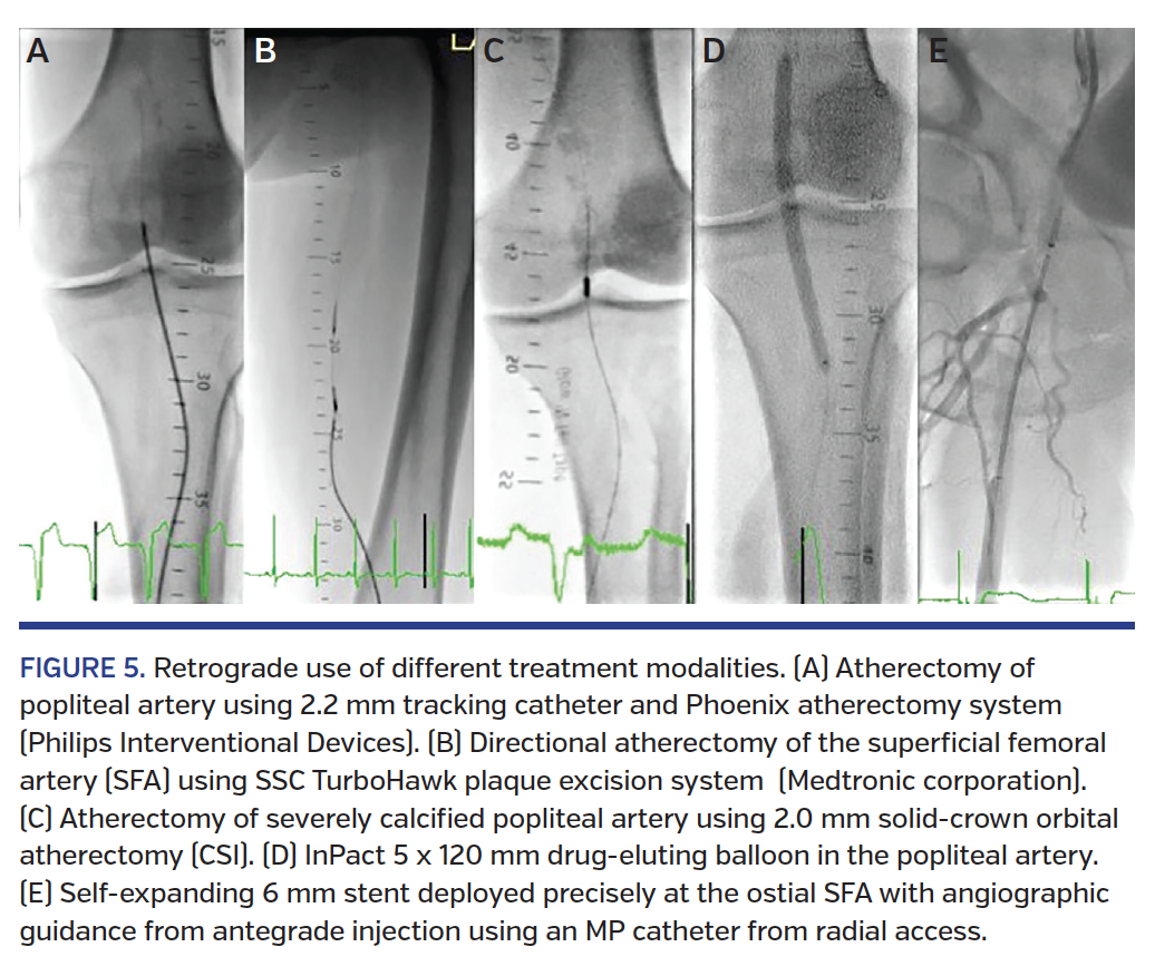 FIGURE 5. Retrograde use of different treatment modalities.