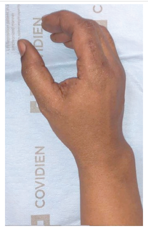 Figure 6 Mukit Masson