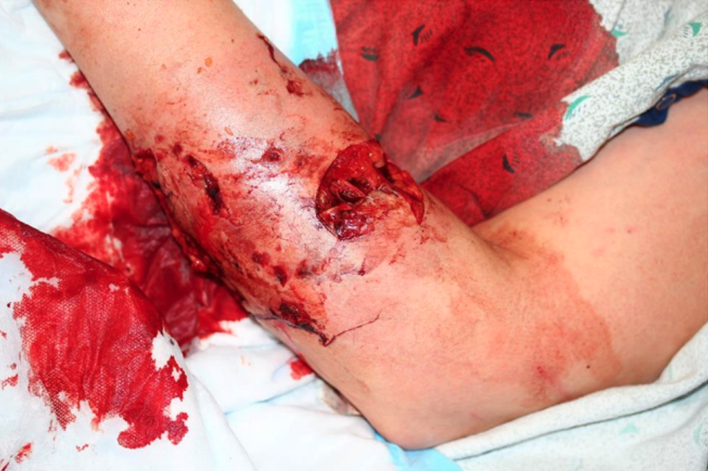 Initial injury evaluation