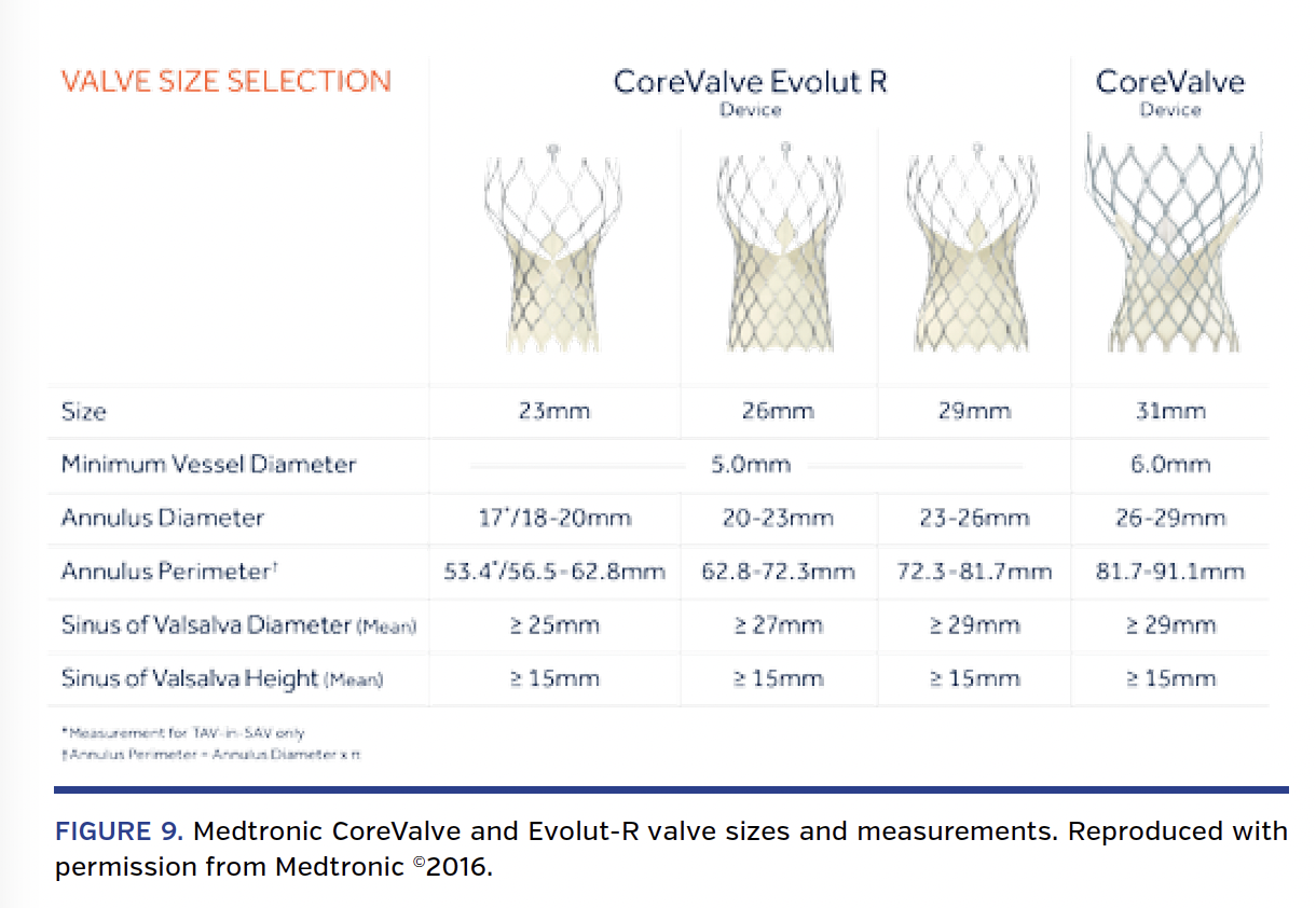 FIGURE 9. Medtronic CoreValve and Evolut-R valve sizes and measurements. Reproduced with permission from Medtronic ©2016.