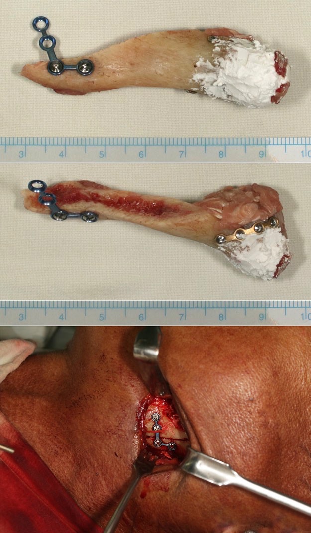 Figure 2 Hwang Smoking 