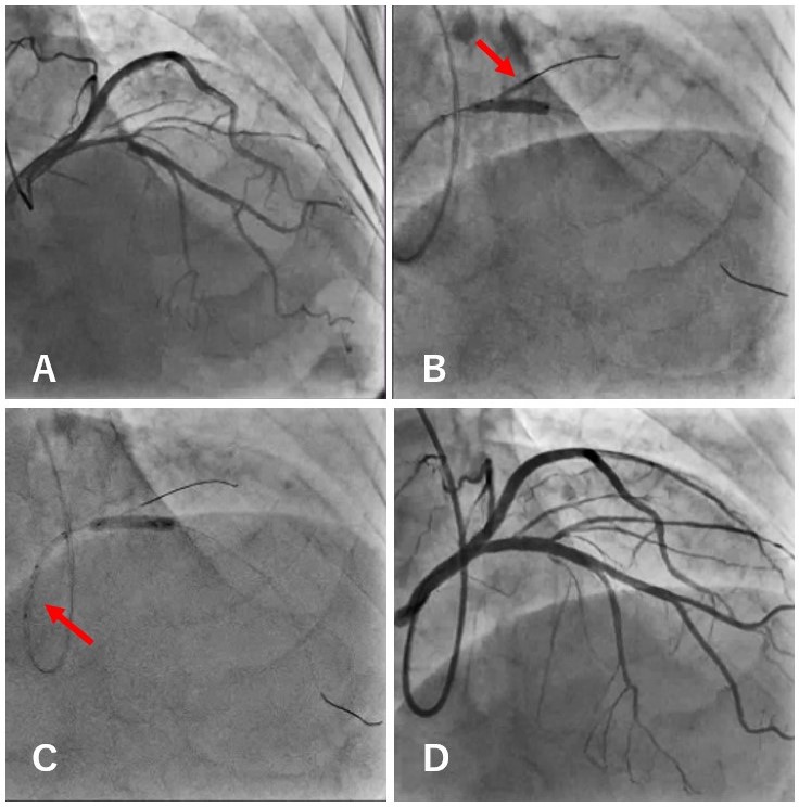 Figure 2. Representative case