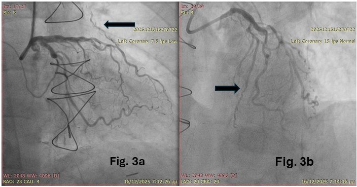 Figure 3. Images of the second procedure.