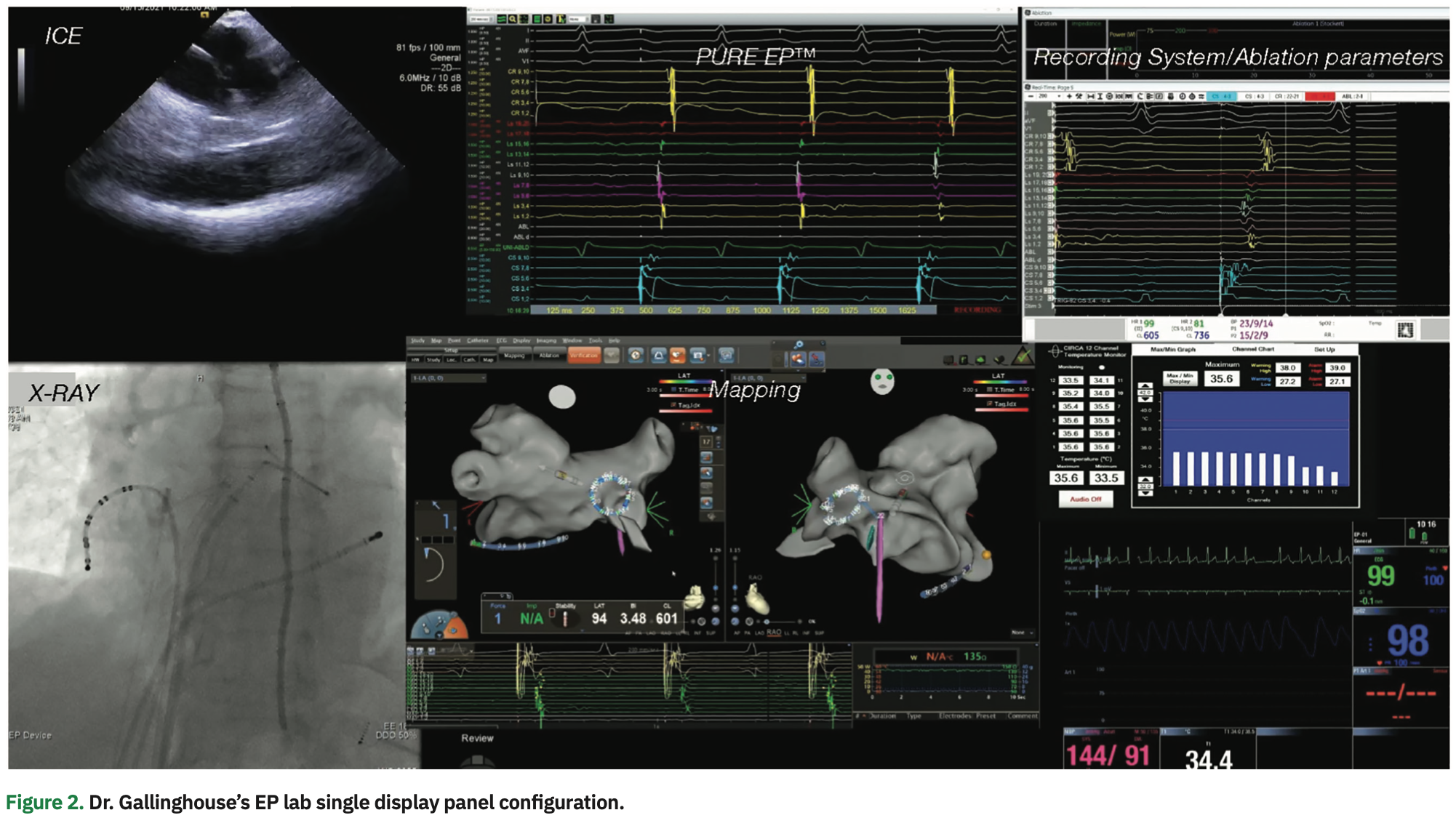 Gallinghouse Intracardiac Figure 2