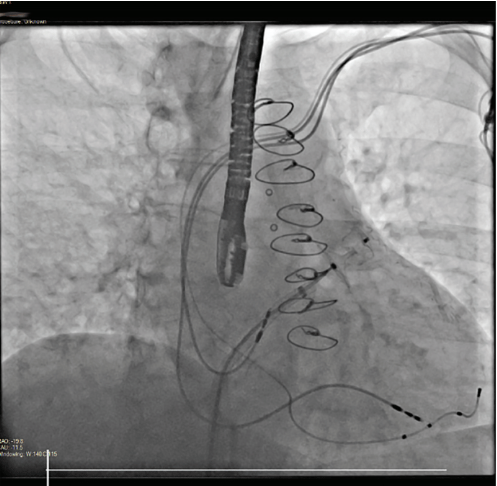 Gambhir-Fig4-Jan2025