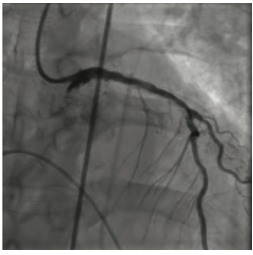 Gbur Multivessel Figure 2