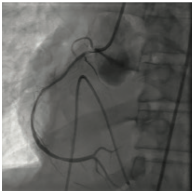 Gbur Multivessel Figure 6