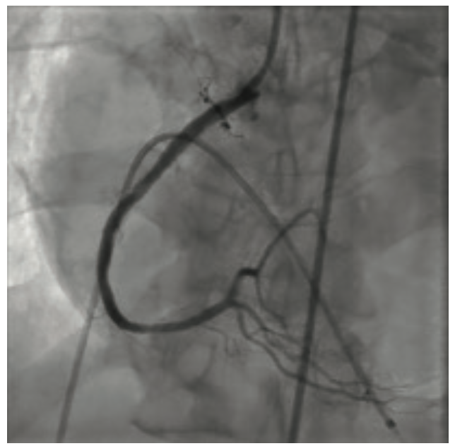 Gbur Multivessel Figure 7