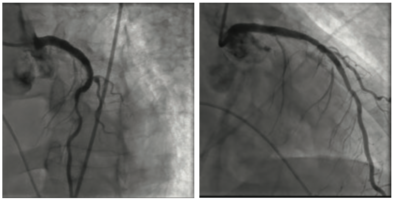 Gbur Multivessel Figures 4-5