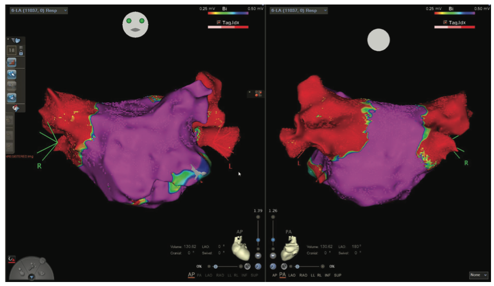 Golian Tunnel Vision Figure 3