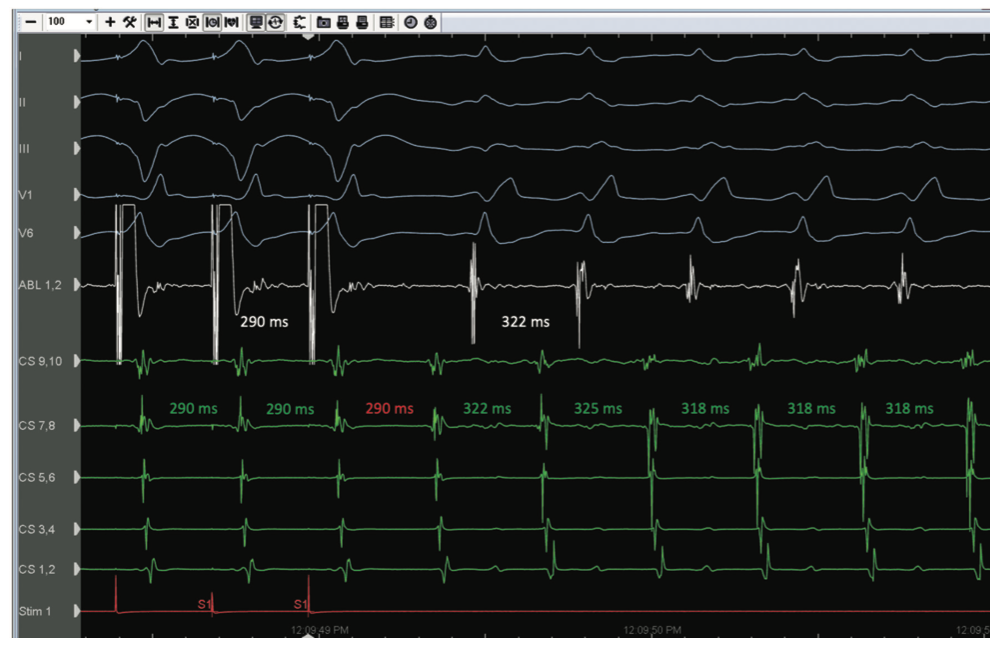 Golian Tunnel Vision Figure 9