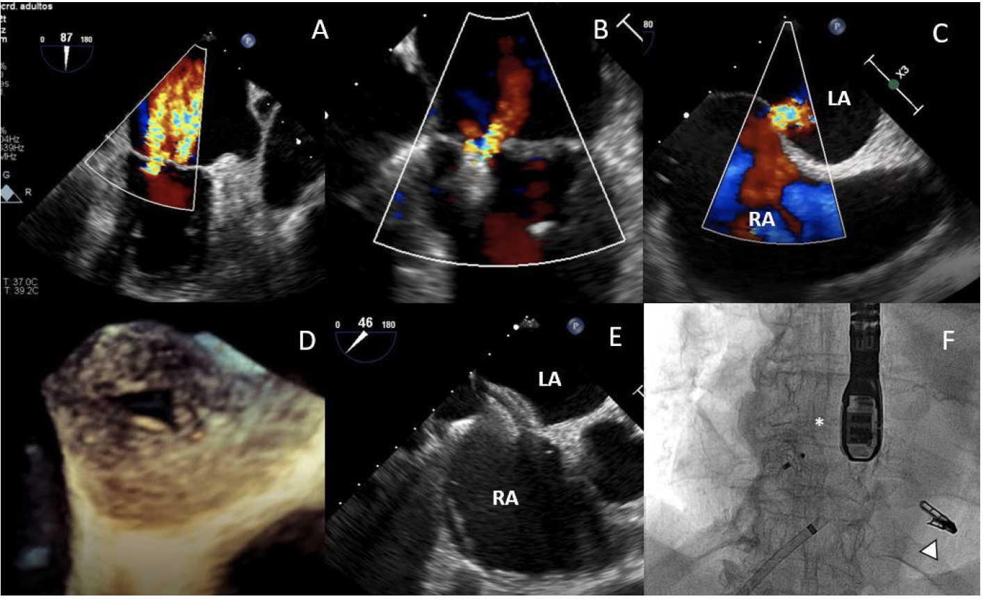 Gonzálvez-García Three Devices On One Fig 1