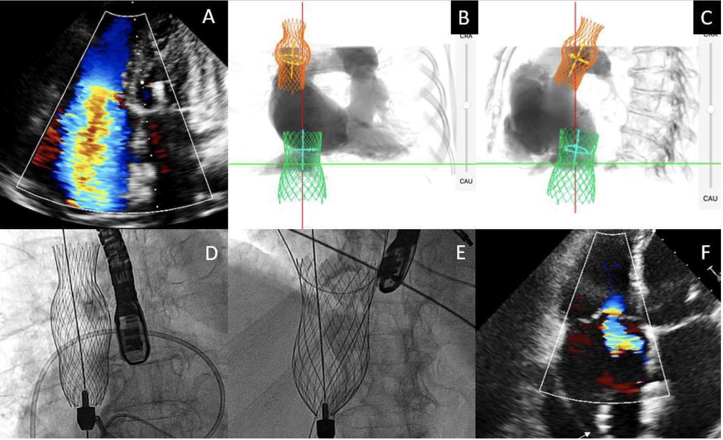 Gonzálvez-García Three Devices On One Fig 2