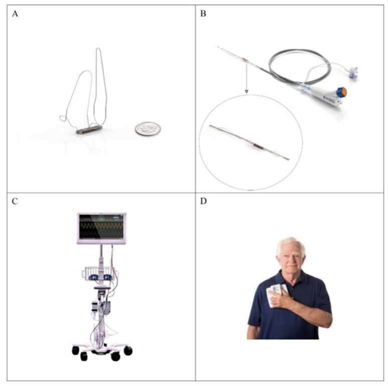 Guichard Pulmonary Artery Figure 2
