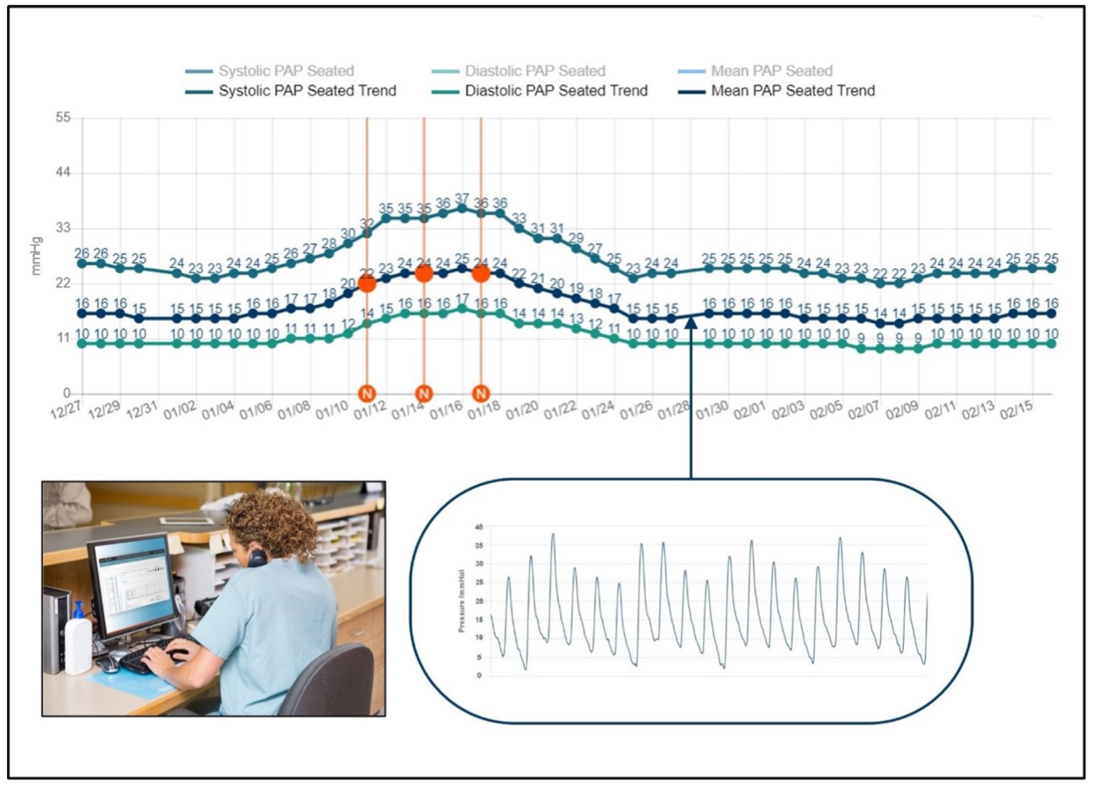 Guichard Pulmonary Artery Figure 4