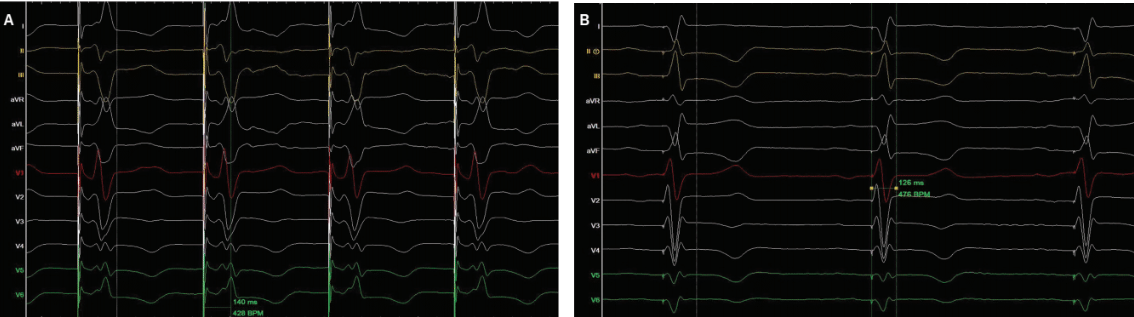 Gul - Fig 2 - Oct 2024 