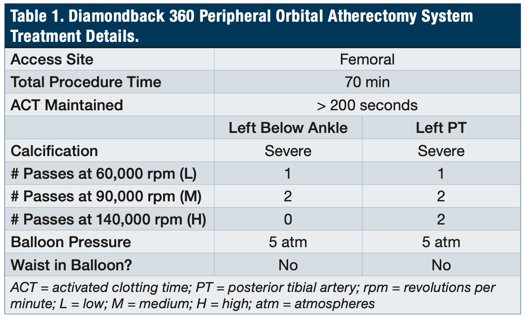 Gupta Limb Salvage Table 1