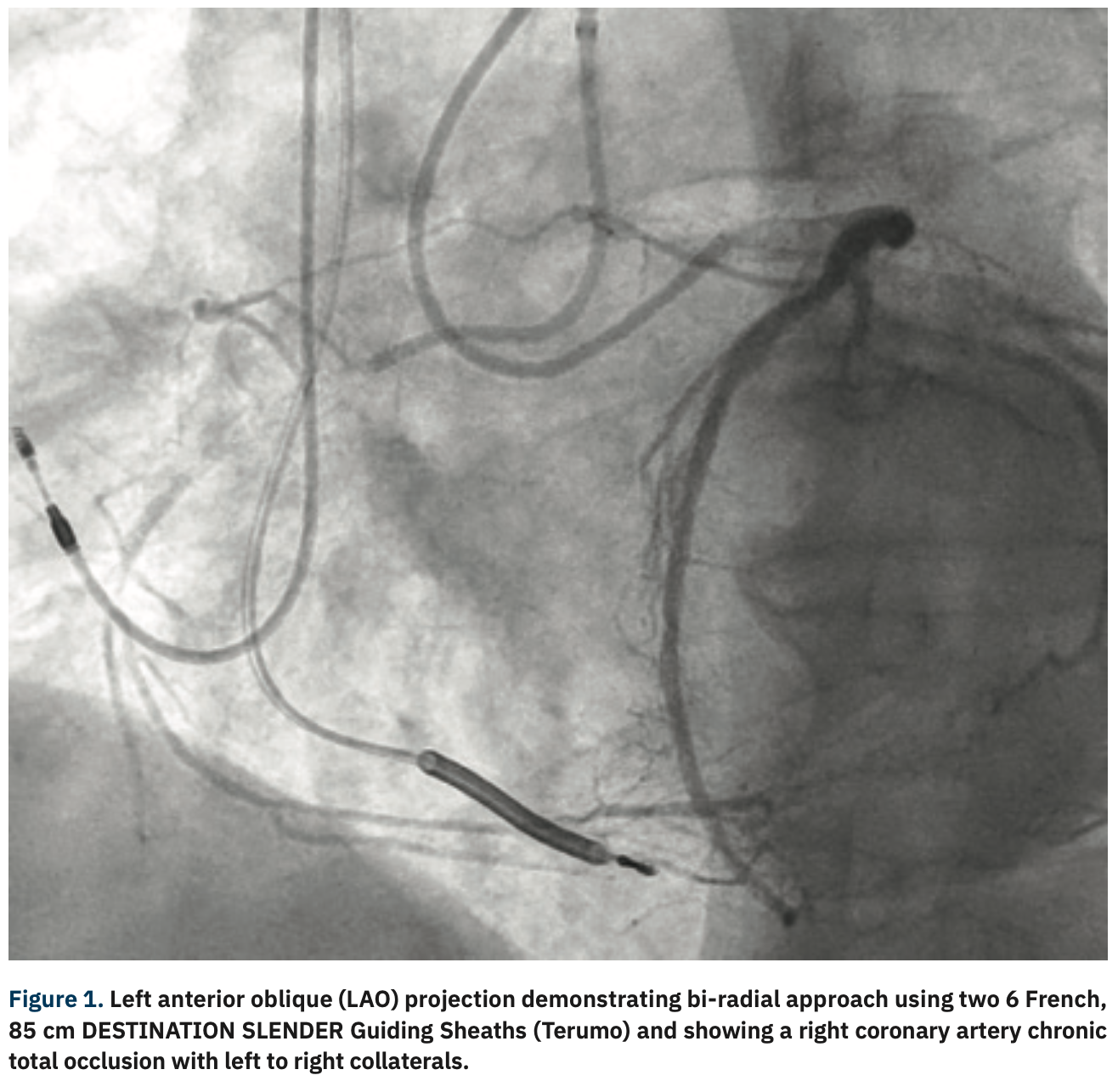 Gurevich CTO Figure 1