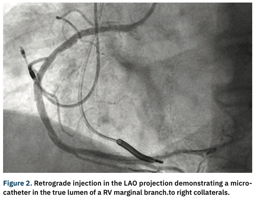 Gurevich CTO Figure 2