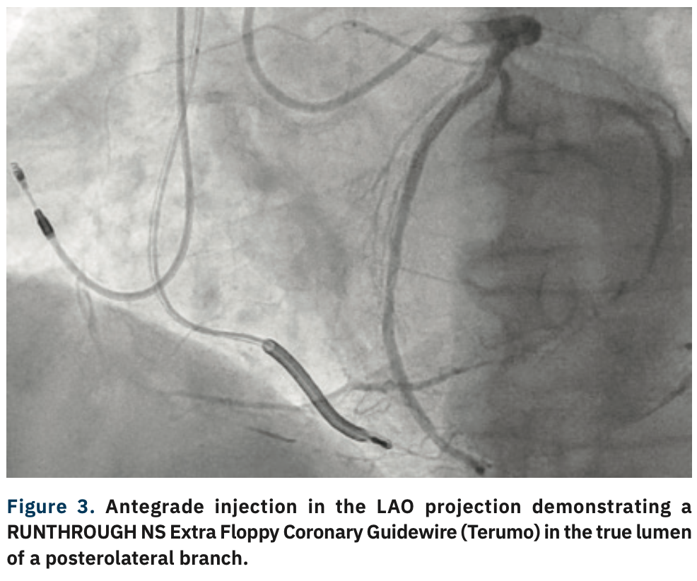 Gurevich CTO Figure 3
